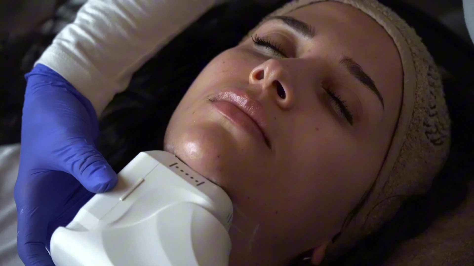 HIFU Gesichtsbehandlung mit fokussiertem Ultraschall bei NABEAU in Berlin-Charlottenburg
